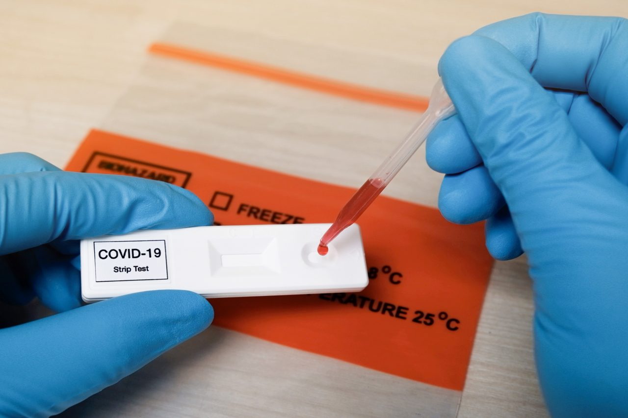 Rapid Covid 19 Strip Test