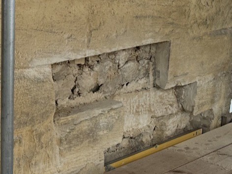 Recent Stone Removal For Repair And Replacement
